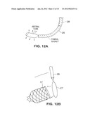 SATIATION DEVICES AND METHODS diagram and image