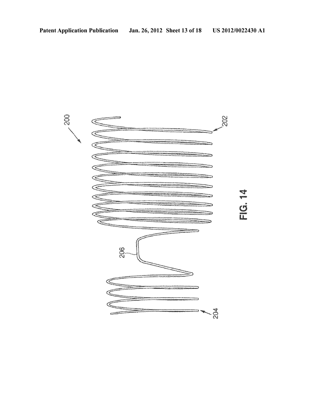 SATIATION DEVICES AND METHODS - diagram, schematic, and image 14