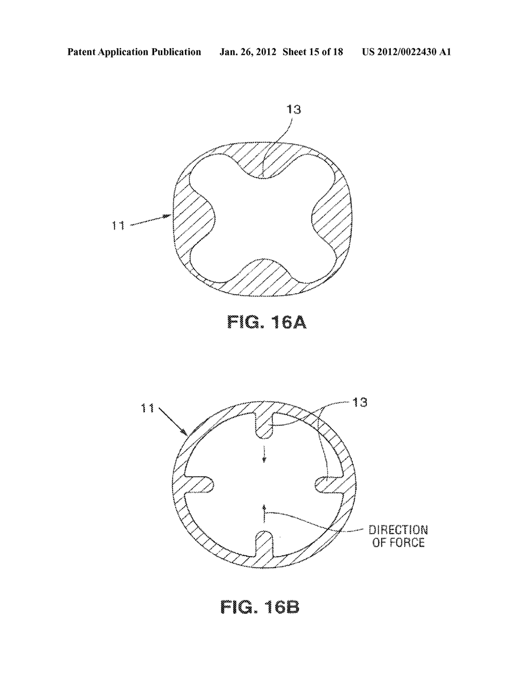 SATIATION DEVICES AND METHODS - diagram, schematic, and image 16