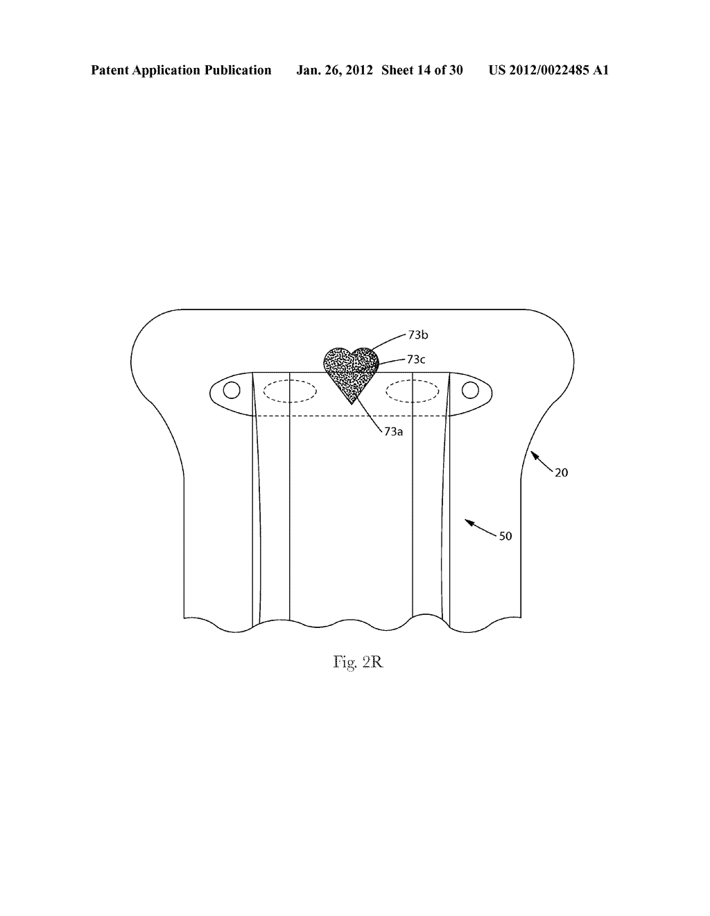 Two-Piece Wearable Absorbent Article With Advantageous Fastener     Performance Configurations - diagram, schematic, and image 15