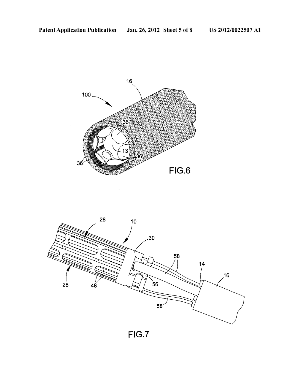 DELIVERY SYSTEM, METHOD, AND ANCHOR FOR MEDICAL IMPLANT PLACEMENT - diagram, schematic, and image 06