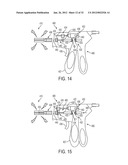 ELECTROSURGICAL CUTTING AND SEALING INSTRUMENT diagram and image