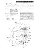 SEMI-DYNAMIC FIXATION PLATE SYSTEM diagram and image