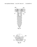 SEMI-DYNAMIC FIXATION PLATE SYSTEM diagram and image