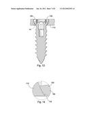 SEMI-DYNAMIC FIXATION PLATE SYSTEM diagram and image