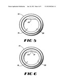 CONTAINMENT SYSTEM FOR CONSTRAINING A PROSTHETIC COMPONENT diagram and image