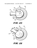 CONTAINMENT SYSTEM FOR CONSTRAINING A PROSTHETIC COMPONENT diagram and image