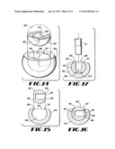 CONTAINMENT SYSTEM FOR CONSTRAINING A PROSTHETIC COMPONENT diagram and image