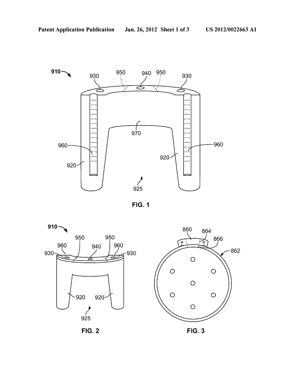 IMPLANT COMPONENTS AND METHODS - diagram, schematic, and image 02