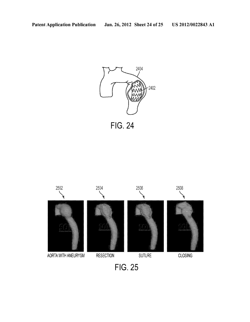 Method and System for Comprehensive Patient-Specific Modeling of the Heart - diagram, schematic, and image 25