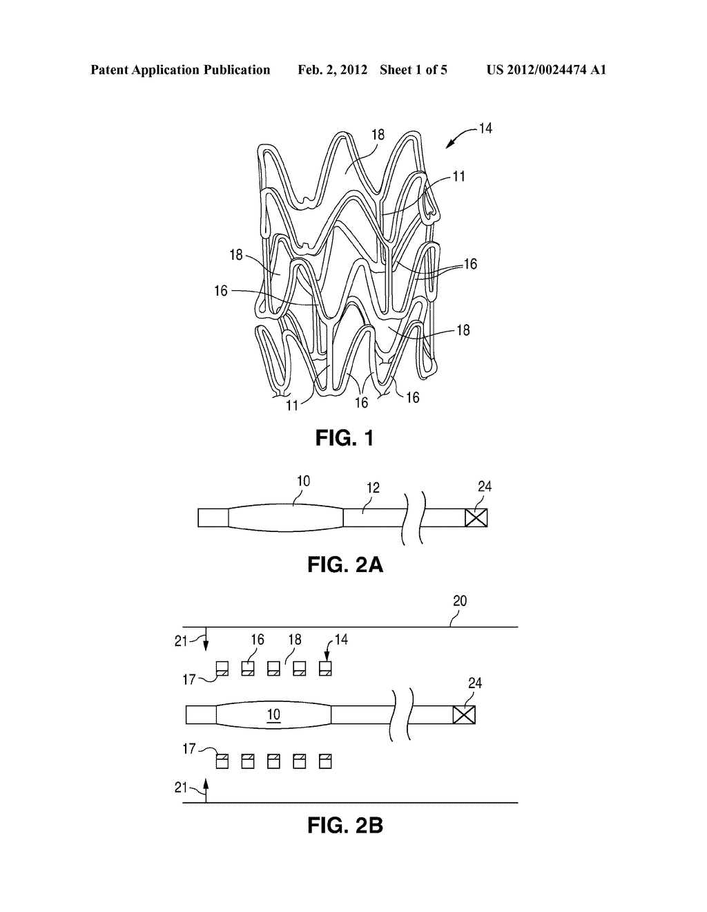 METHODS FOR IMPROVED STENT RETENTION - diagram, schematic, and image 02