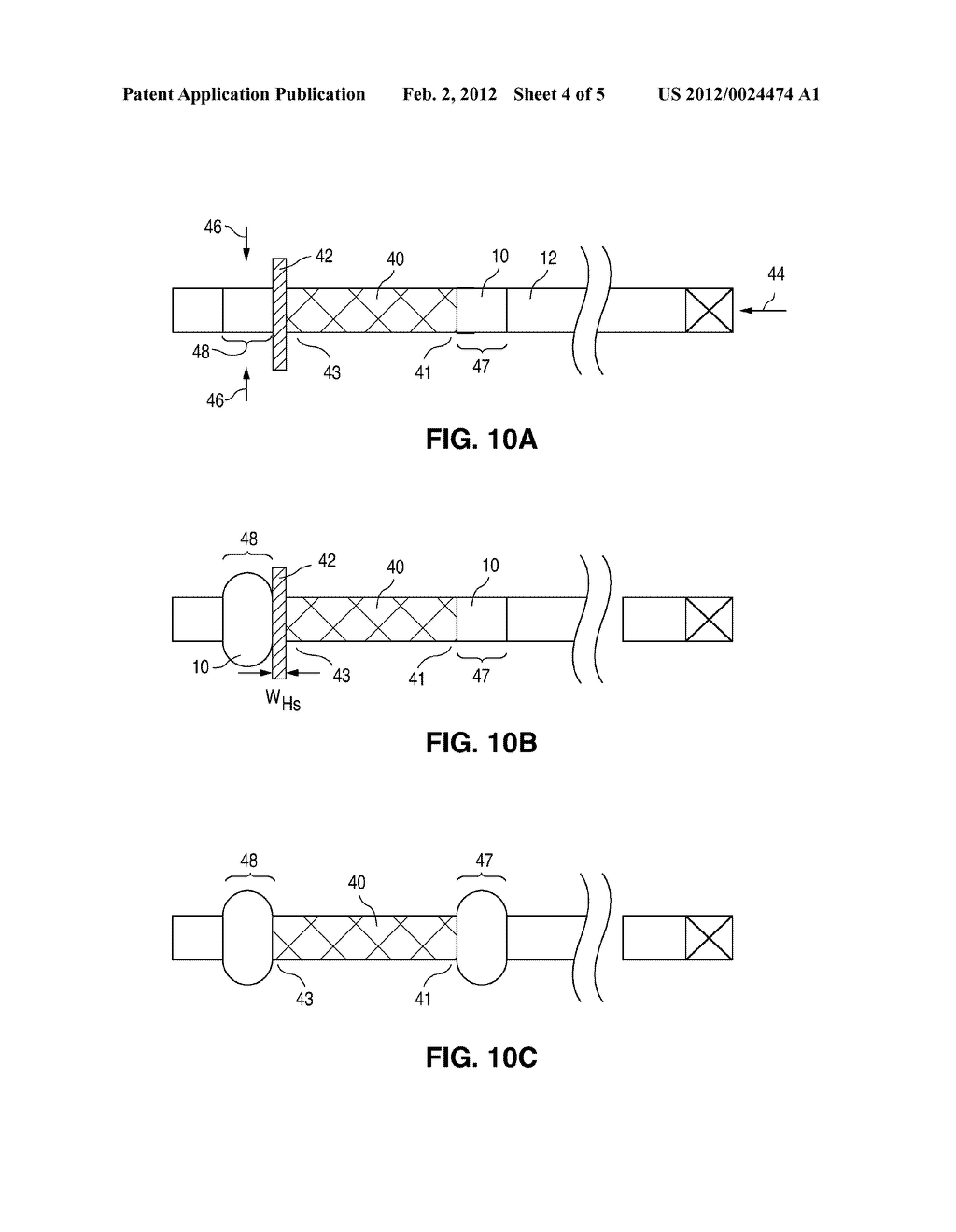 METHODS FOR IMPROVED STENT RETENTION - diagram, schematic, and image 05