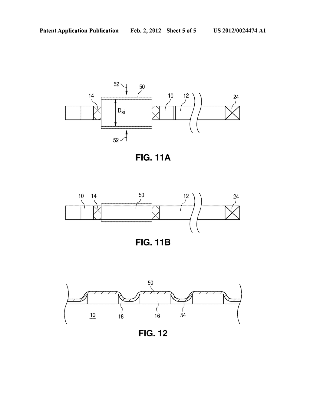 METHODS FOR IMPROVED STENT RETENTION - diagram, schematic, and image 06