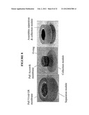 DEVICES AND METHODS FOR FILTERING BLOOD PLASMA diagram and image