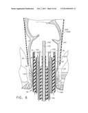 TISSUE ACQUISITION ARRANGEMENTS AND METHODS FOR SURGICAL STAPLING DEVICES diagram and image