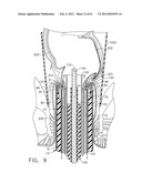 TISSUE ACQUISITION ARRANGEMENTS AND METHODS FOR SURGICAL STAPLING DEVICES diagram and image