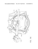 TISSUE ACQUISITION ARRANGEMENTS AND METHODS FOR SURGICAL STAPLING DEVICES diagram and image