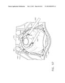 TISSUE ACQUISITION ARRANGEMENTS AND METHODS FOR SURGICAL STAPLING DEVICES diagram and image