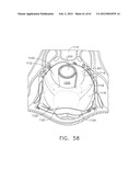 TISSUE ACQUISITION ARRANGEMENTS AND METHODS FOR SURGICAL STAPLING DEVICES diagram and image