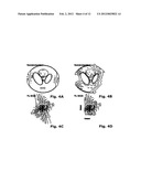 Method of MR (=magnetic resonance) with spatial encoding to generate an     image of spectroscopic data diagram and image