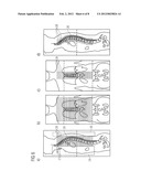 METHOD AND MAGNETIC RESONANCE SYSTEM TO GENERATE MAGNETIC RESONANCE IMAGES diagram and image