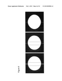 Method For Reducing Artifacts In Magnetic Resonance Imaging diagram and image