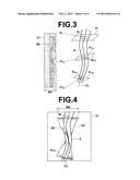 DIAGNOSIS ASSISTING APPARATUS, DIAGNOSIS ASSISTING PROGRAM, AND DIAGNOSIS     ASSISTING METHOD diagram and image