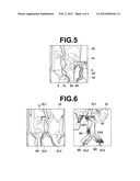 DIAGNOSIS ASSISTING APPARATUS, DIAGNOSIS ASSISTING PROGRAM, AND DIAGNOSIS     ASSISTING METHOD diagram and image