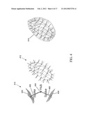 METHODS, SYSTEMS, AND COMPUTER READABLE MEDIA FOR MAPPING REGIONS IN A     MODEL OF AN OBJECT COMPRISING AN ANATOMICAL STRUCTURE FROM ONE IMAGE DATA     SET TO IMAGES USED IN A DIAGNOSTIC OR THERAPEUTIC INTERVENTION diagram and image