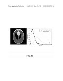 Apparatus, System, and Method for Non-Convex Prior Image Constrained     Compressed Sensing diagram and image