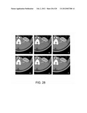 Apparatus, System, and Method for Non-Convex Prior Image Constrained     Compressed Sensing diagram and image