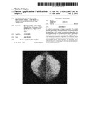 METHOD AND APPARATUS FOR PROCESSING IMAGE, AND MEDICAL IMAGE SYSTEM     EMPLOYING THE APPARATUS diagram and image