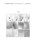 Methods for Distributing High Levels of Therapeutic Agent Throughout the     Cortex to Treat Neurological Disorders diagram and image