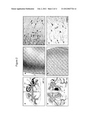 Methods for Distributing High Levels of Therapeutic Agent Throughout the     Cortex to Treat Neurological Disorders diagram and image
