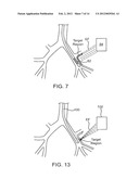 SYSTEMS AND METHODS FOR DELIVERY OF A THERAPEUTIC AGENT diagram and image