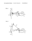 MAGNETOFLUIDIC HEARING AID SYSTEM AND HEARING AID diagram and image