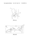 SYSTEM AND METHOD FOR REDUCING FALSE ALARMS ASSOCIATED WITH VITAL-SIGNS     MONITORING diagram and image