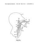 AIRWAY ADJUNCT RESUSCITATION SYSTEMS AND METHODS diagram and image