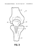 NONINVASIVE DIAGNOSTIC SYSTEM diagram and image