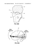 NONINVASIVE DIAGNOSTIC SYSTEM diagram and image