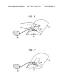 DEVICE AND METHOD FOR COMPRESSING WOUNDS diagram and image