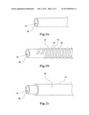 Irrigation Catheter and a Method of Fabricating diagram and image