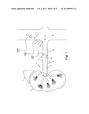 Cooled Conductive Balloon RF Catheter for Renal Nerve Ablation diagram and image