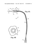 Cooled Conductive Balloon RF Catheter for Renal Nerve Ablation diagram and image