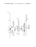 Cooled Conductive Balloon RF Catheter for Renal Nerve Ablation diagram and image