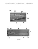 SPINAL CORD STIMULATION SYSTEM AND METHODS OF USING SAME diagram and image