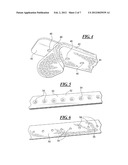 METHOD AND APPARATUS FOR SURGICALLY CLOSING AN OPEN ABDOMEN diagram and image