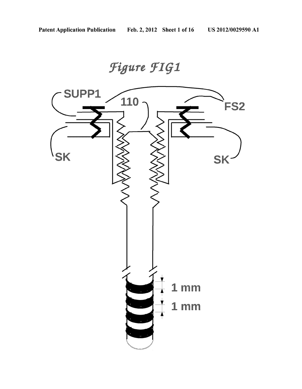 Method and means to adjust the positioning of stimulating neural and     muscular electrode - diagram, schematic, and image 02