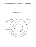 Method and means to adjust the positioning of stimulating neural and     muscular electrode diagram and image