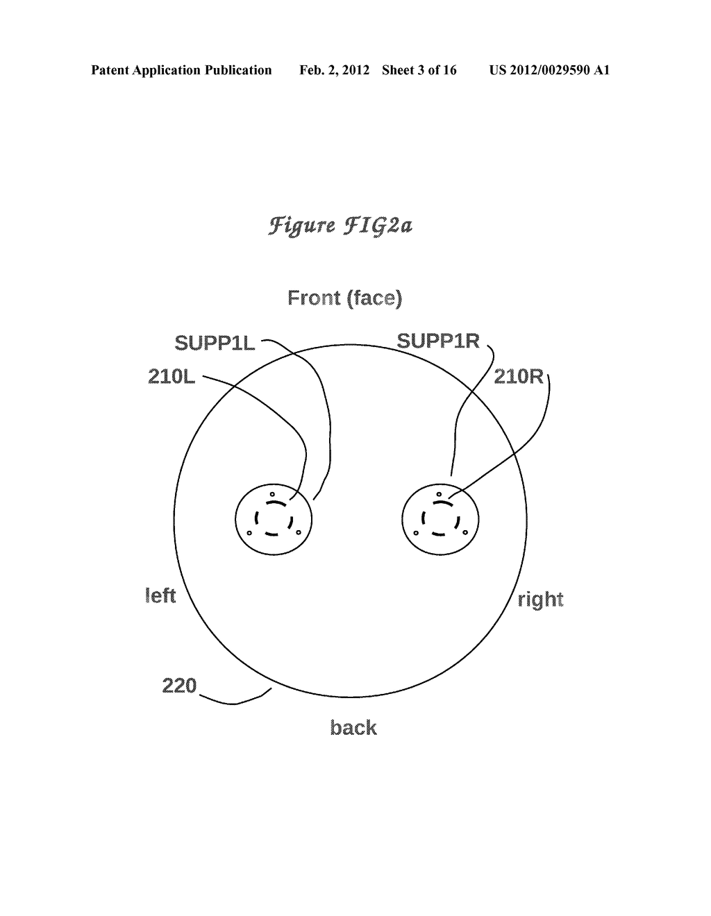 Method and means to adjust the positioning of stimulating neural and     muscular electrode - diagram, schematic, and image 04